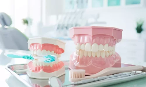 Çocuklarda ve Yetişkinlerde Crossbite (Çapraz Kapanış): Neden Zamanlama Önemlidir - Milim Dental Hospital