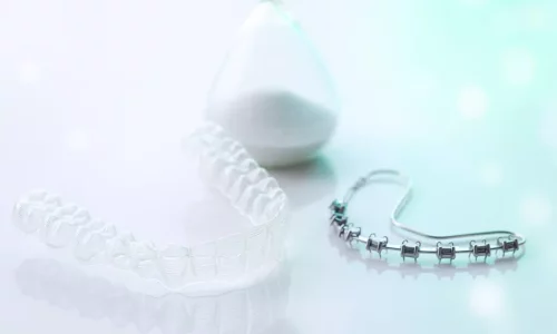 Ortodontik tedavi genellikle ne kadar sürer? - Milim Dental Hospital