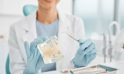 Seramik diş telleri daha mı kırılgan? - Milim Dental Hospital
