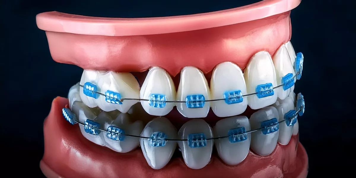 Düz Dişler, Sağlıklı Çeneler: Ortodontinin Sadece Görünüşle İlgili Olmamasının Nedenleri