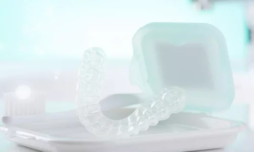Tedaviden sonra hangi retainer kullanılır? - Milim Dental Hospital