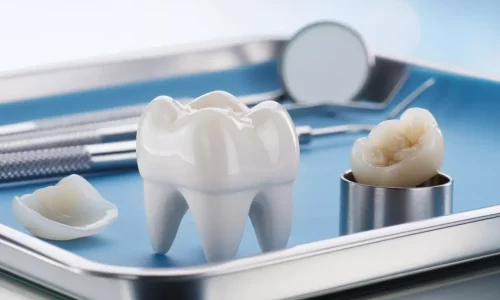 Uzun Vadeli Bakım (Veneers & Crowns) - Milim Dental Hospital