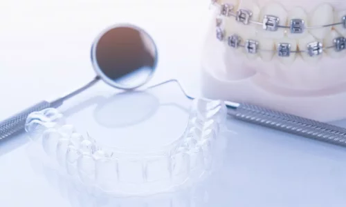 Invisalign Her Durum İçin Uygun mu? - Milim Dental Hospital