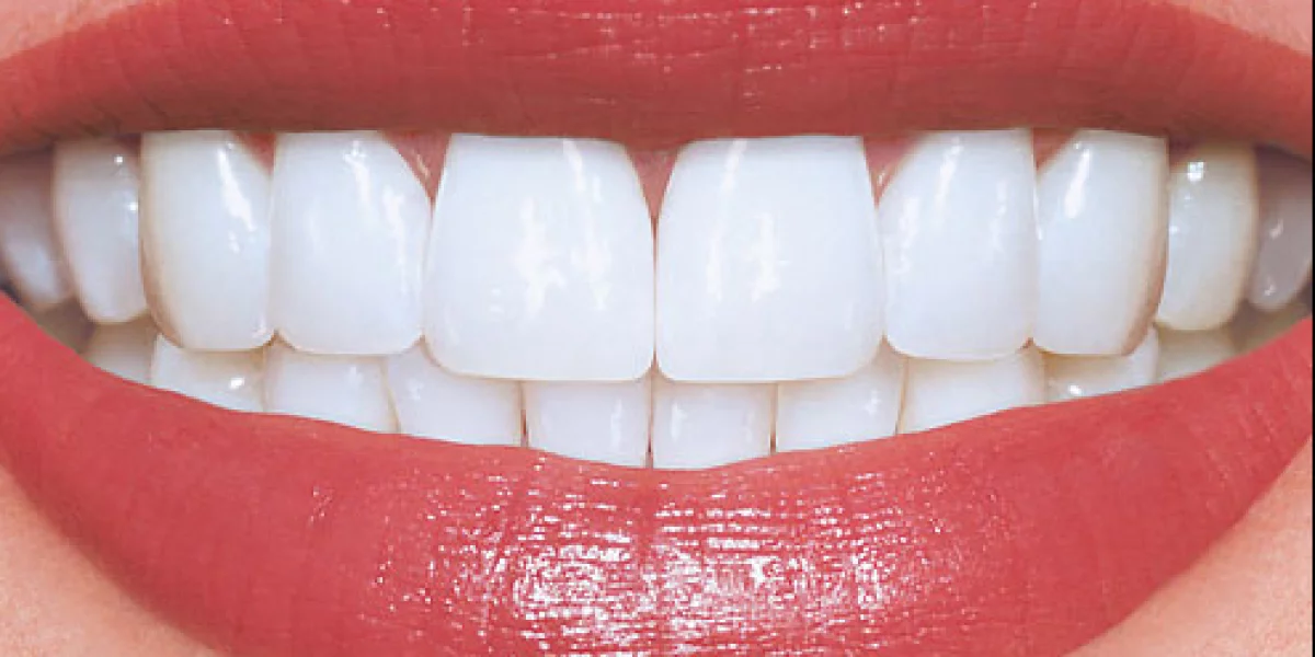 Zirconyum Kronları Hakkında Bilmeniz Gereken Her Şey