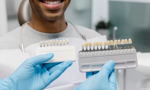 "Türkiye Dişleri" Mitleri (Veneerlar vs Kronlar) SSS 9.1 — Hollywood gülüşü için kronlar her zaman gerekli midir? - Milim Dental Hospital