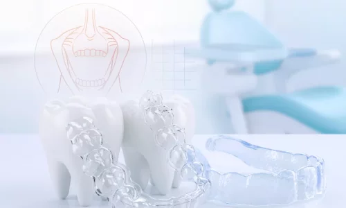 Diş Sıkma Ortodontisi - Milim Dental Hospital
