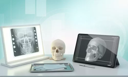 Röntgen veya dijital taramalara ihtiyacım var mı? - Milim Dental Hospital