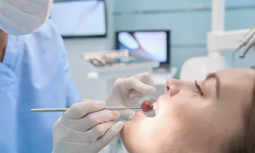 IPR (Interproksimal Redüksiyon): Diş Törpüleme Gerekli mi? - Milim Dental Hospital