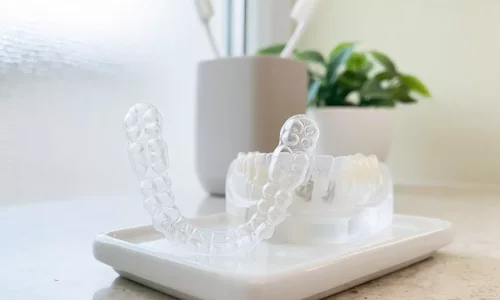 Bruksizm (Diş Sıkma) + Ortodonti: Hala Invisalign Yaptırabilir misiniz? - Milim Dental Hospital