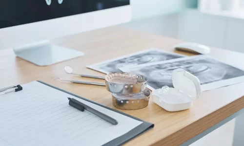 Ortodonti Konsültasyon Kontrol Listesi: Hangi Kayıtlar Gereklidir ve Neden? - Milim Dental Hospital