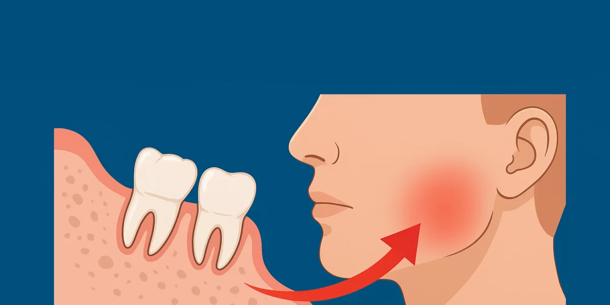Sıkışmış 20 yaş dişi çekimi ve uyuşma riski