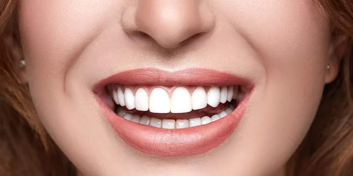 Türkiye'de Hollywood Smile Yaptırmanın Özgüveniniz İçin En Akıllıca Yatırım Olmasının Nedenleri