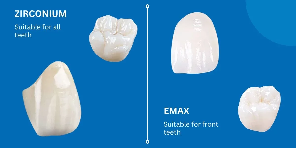 Zirkonyum, E-Max'ten Neden Daha Uygun Fiyatlı? Temel Farklar Açıklandı