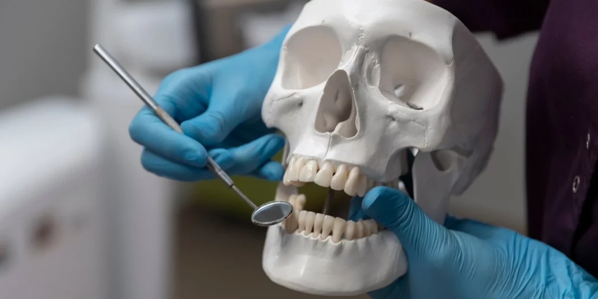 Zygomatik İmplantlar vs. Geleneksel İmplantlar: Hangisi Daha İyi?