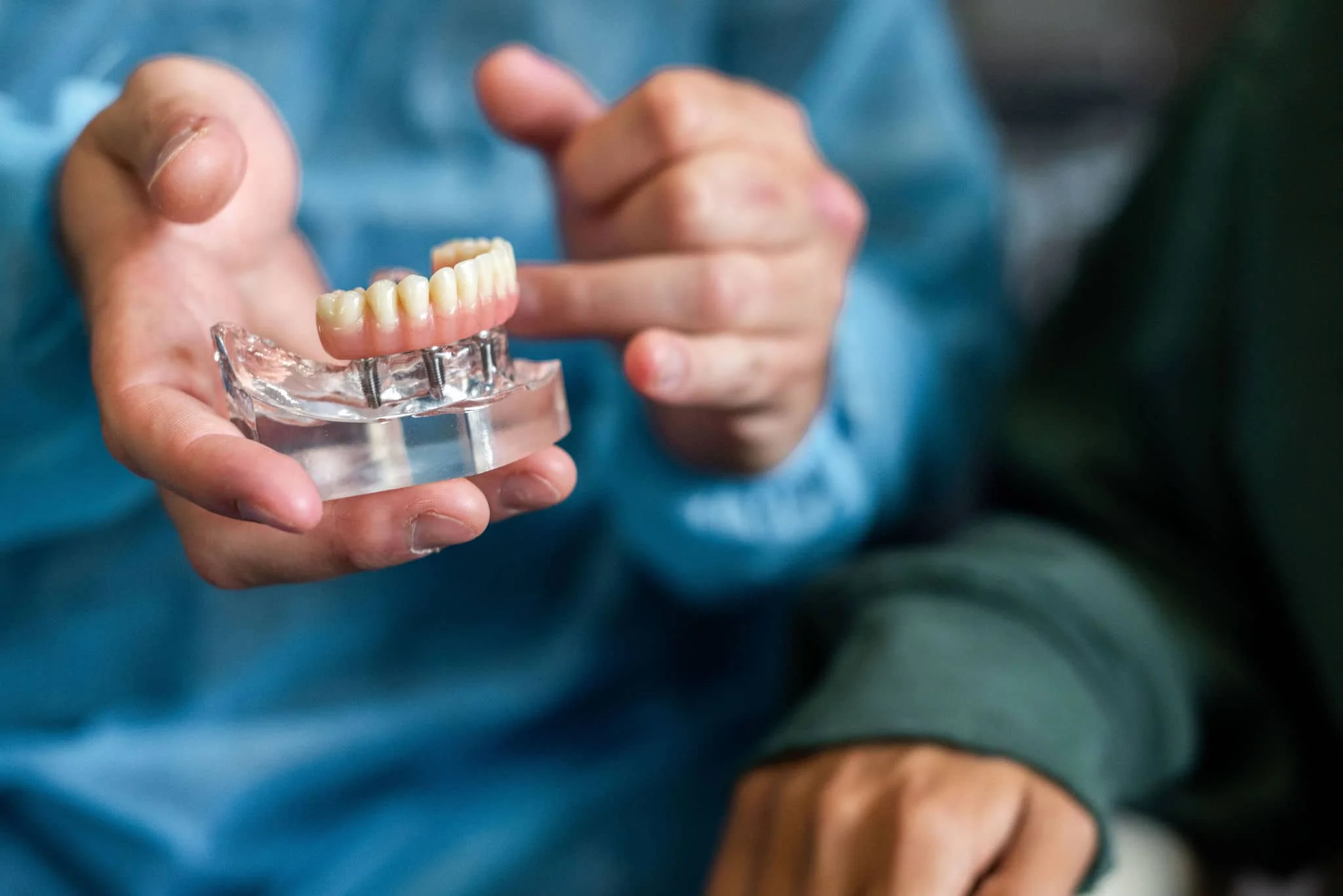 All-on-4 Diş İmplantları: Hayatınızı Değiştiren Bir Çözüm